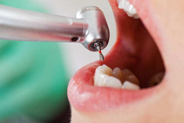 Professional Emergency Dentist in UT